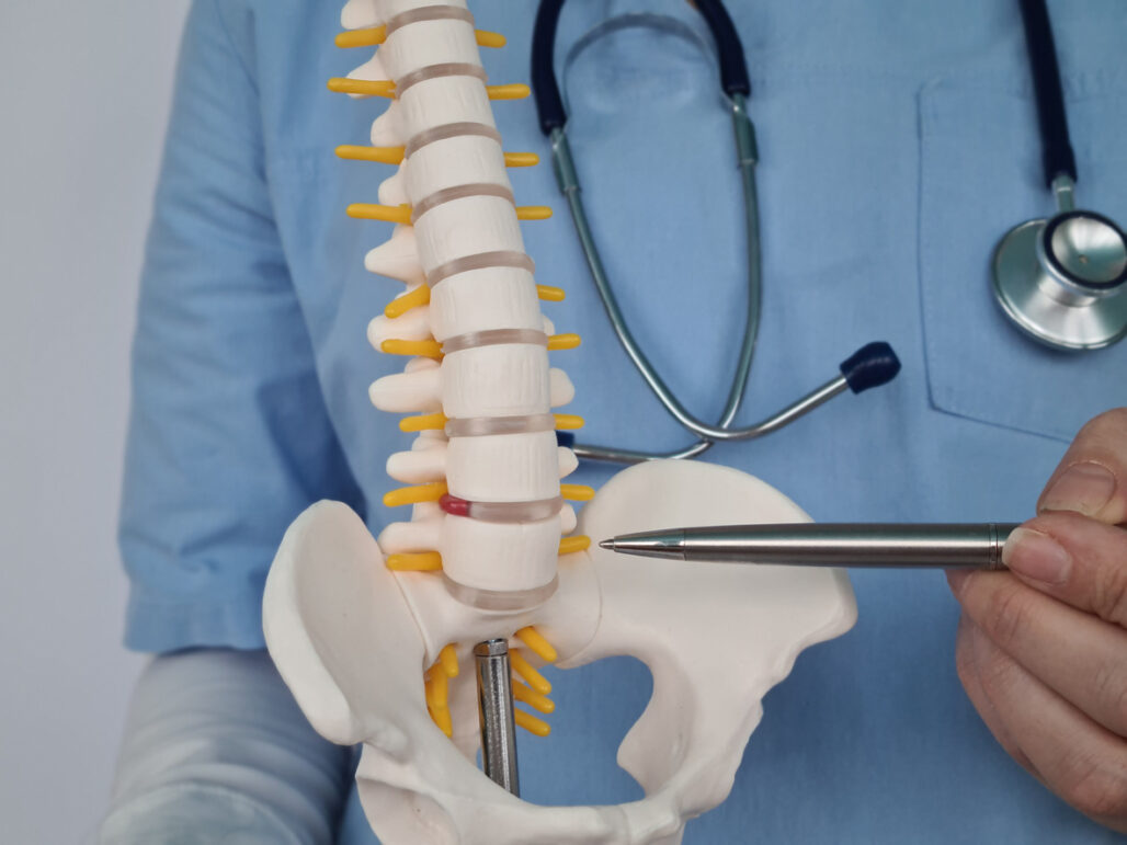 intervertebral discs hernia of displaced joints